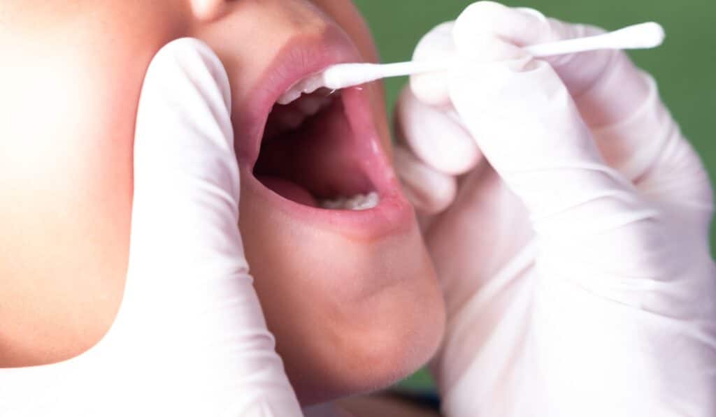 Fluoride Treatment for Kids O'Fallon